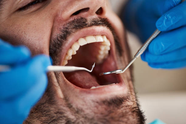 Best Broken or Chipped Tooth Repair in Ceresco, NE